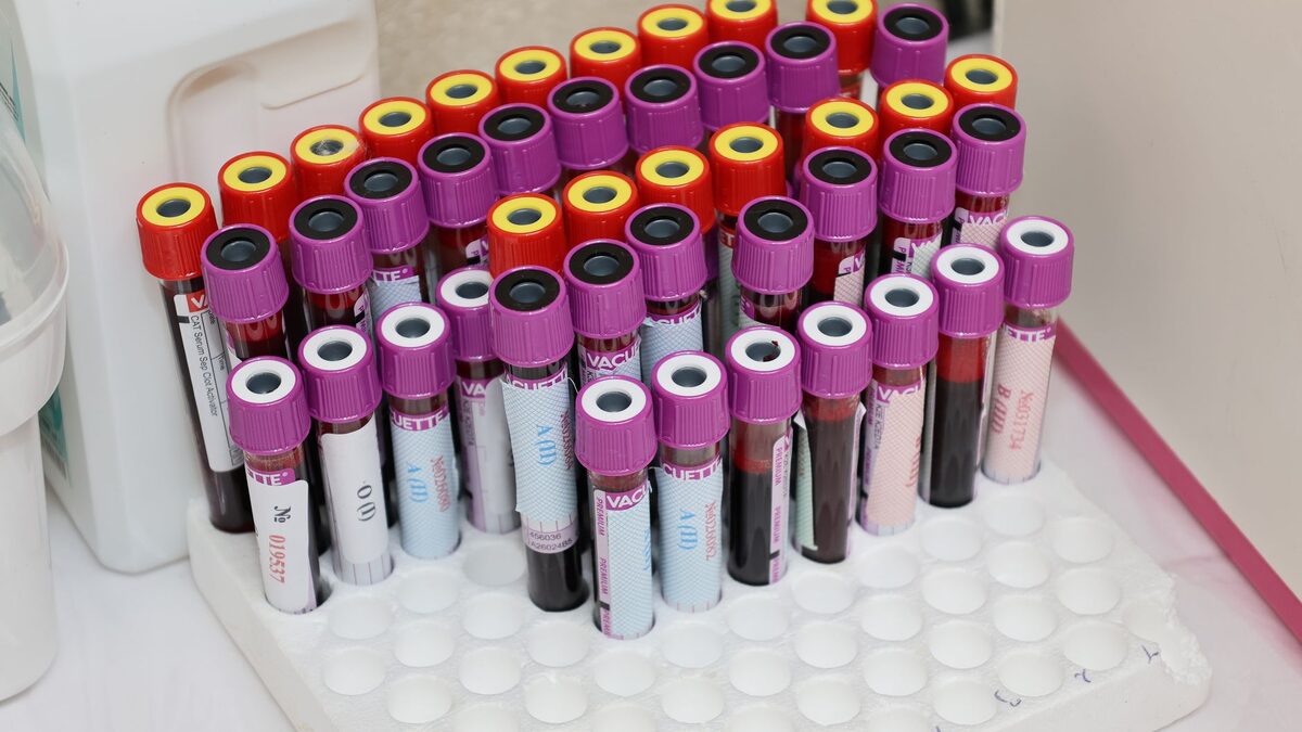 Tubes de prélèvement sanguin alignés dans un laboratoire, support du dosage du cholestérol non HDL