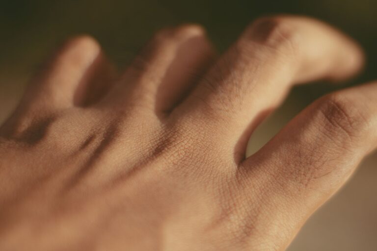 Gros plan sur la texture plissée de la peau d'une main, comme dans la dyshidrose des pieds